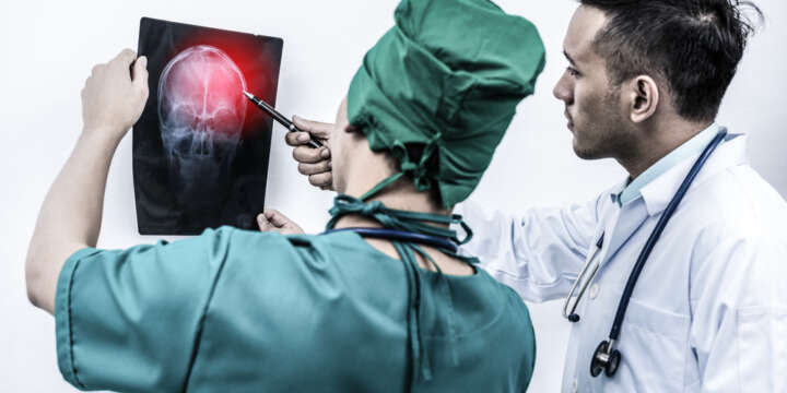 How a Brain Injury Can Affect Your Career
