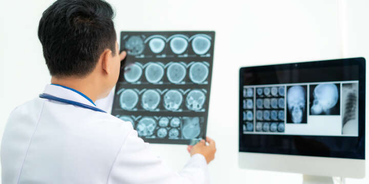 The Importance of Pasadena Brain Injury Attorneys in Your Time of Need