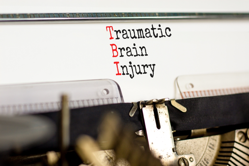 Finding a Skilled Pasadena Brain Injury Lawyer: Jalilvand Law