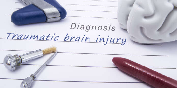 Hiring a Pasadena Brain Injury Attorney: Jalilvand Law Stands With You