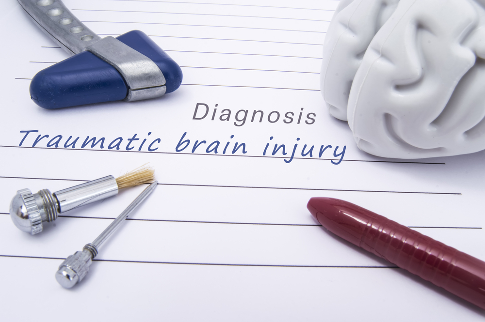 Hiring a Pasadena Brain Injury Attorney: Jalilvand Law Stands With You