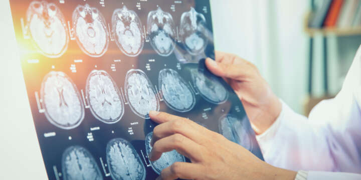 Finding the Right Brain Injury Lawyer in Pasadena, California
